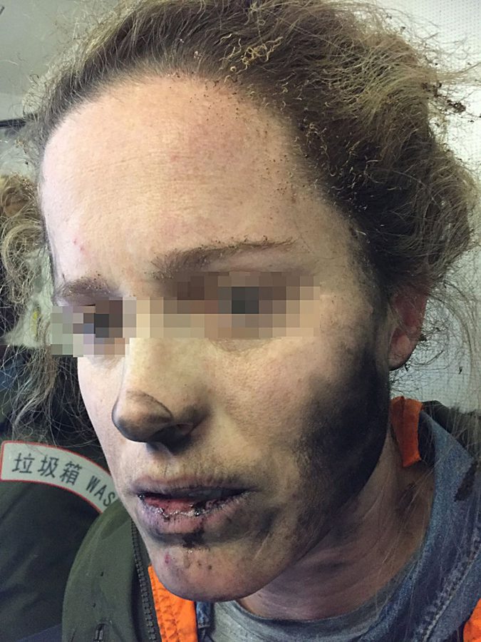 Woman suffers burns after battery-operated headphones explode during flight from Beijing to Melbourne