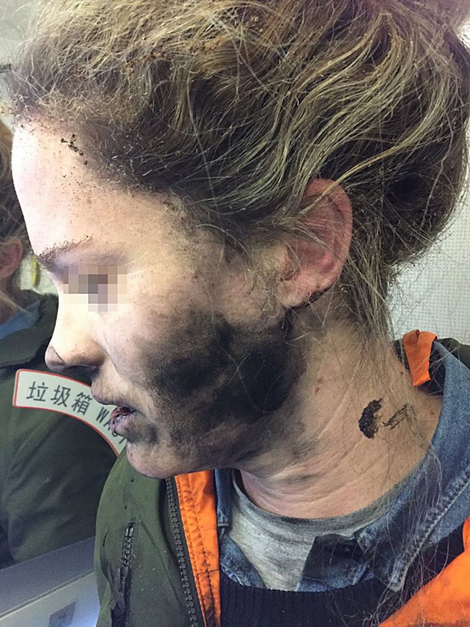 Woman suffers burns after battery-operated headphones explode during flight from Beijing to Melbourne