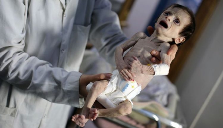 Tragiški vaizdai iš Sirijos: režimas abejingas net badaujantiems kūdikiams